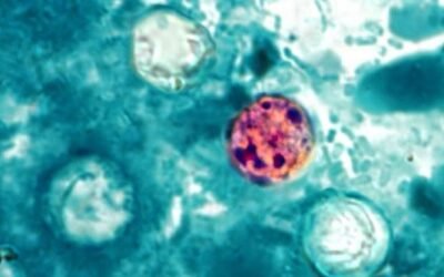 Cyclospora – FDA