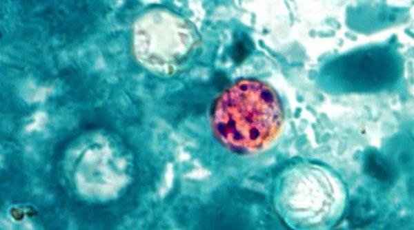 Cyclospora – FDA